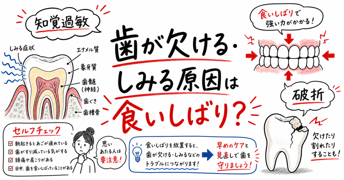 歯が欠ける・しみる原因は食いしばり？セルフチェックと対策を解説