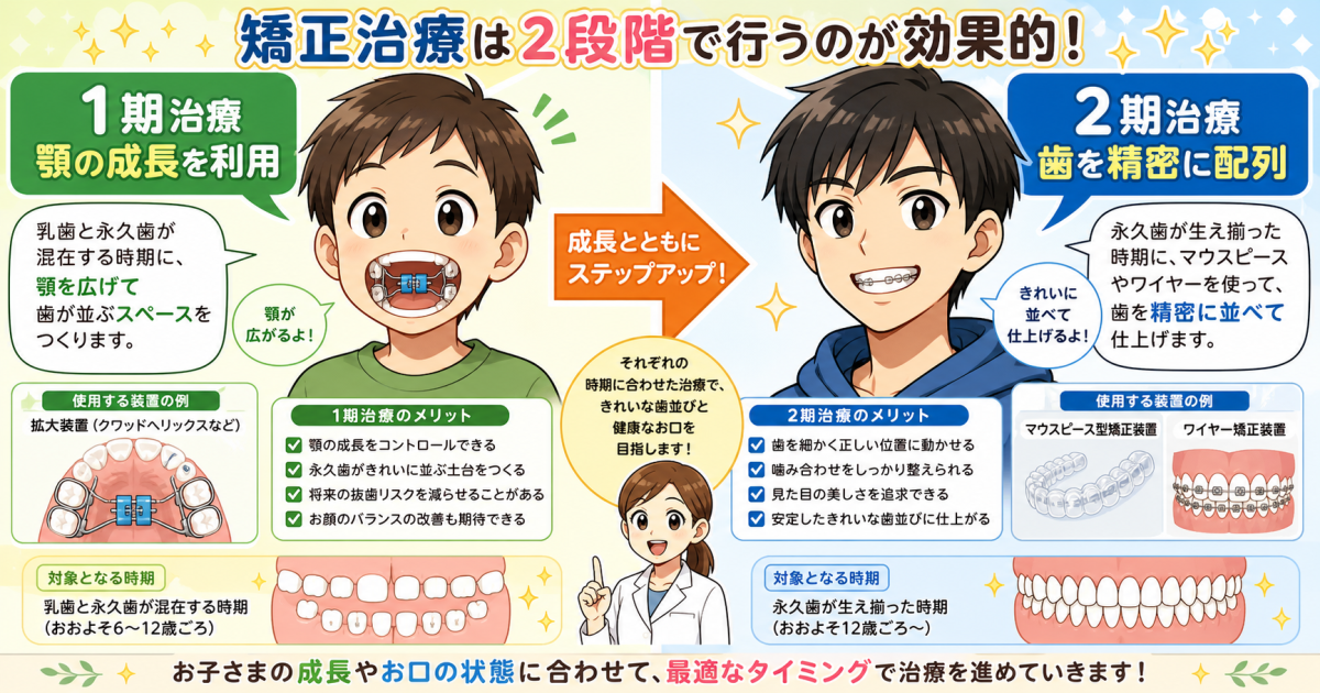 6歳のお子様に現れる「ガタガタ・受け口」のセルフチェックと判断基準