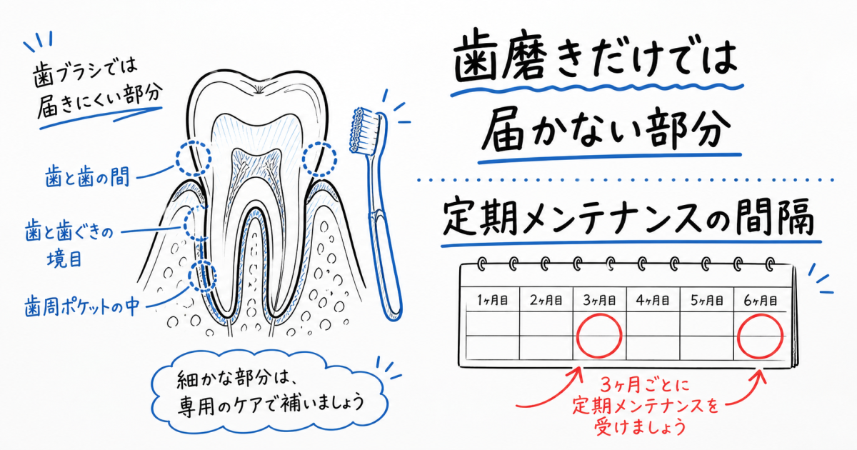 歯磨きだけでは防げない？治療後の歯を守るメンテナンス頻度を解説