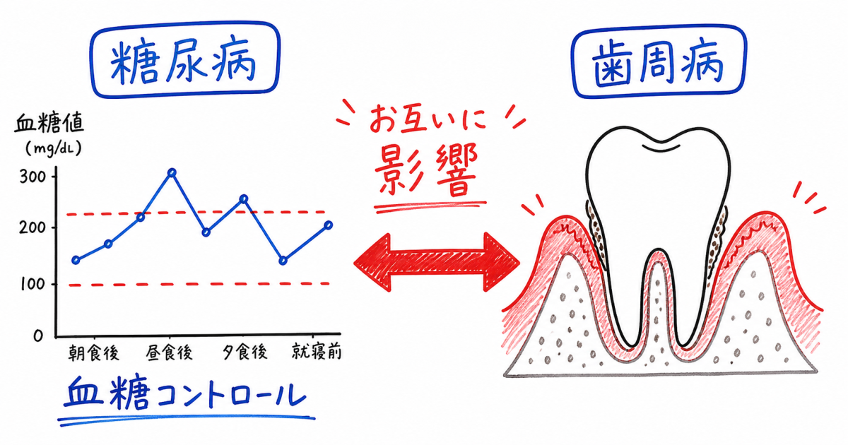 糖尿病で歯ぐきが腫れる？歯周病との関係と血糖値改善のケア法