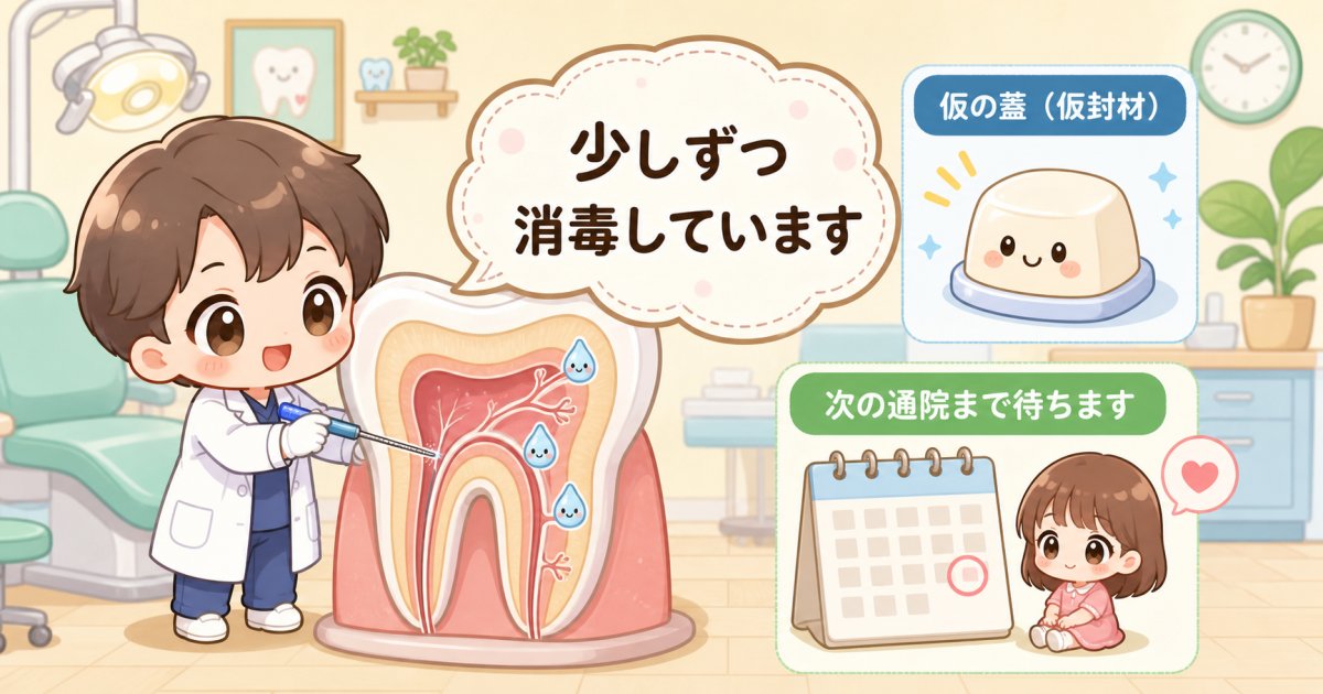なぜ根管治療は何度も通院が必要なのか?治療ステップと理由