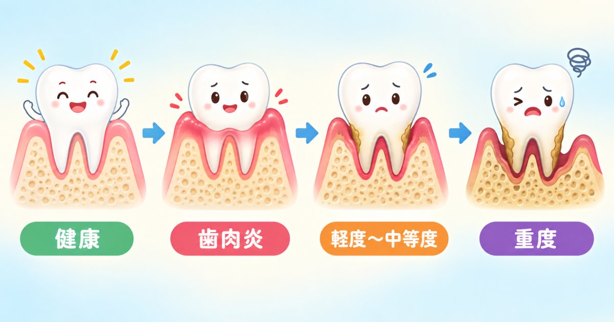 歯周病と歯槽膿漏の違いとは？言葉の定義と進行プロセスの基本