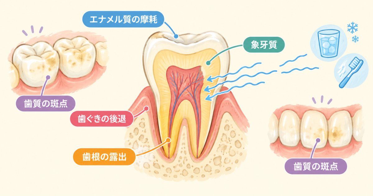 歯がしみやすい人に見られる歯と歯ぐきの特徴