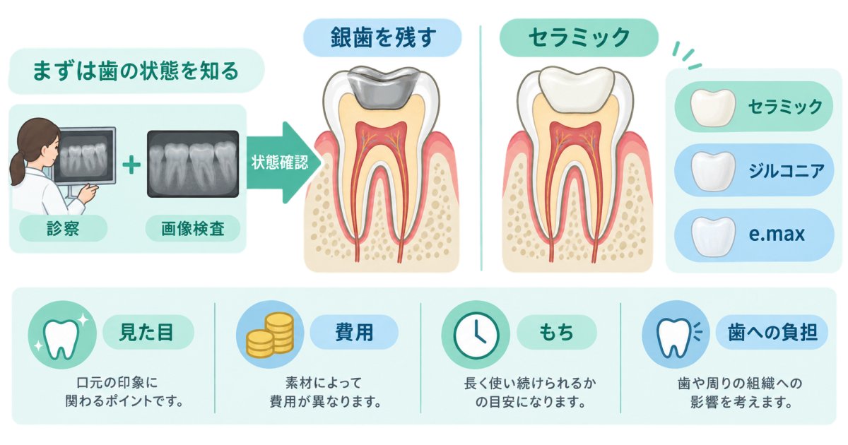 銀歯をセラミックに替えるべき？見た目と費用、歯への負担を考える