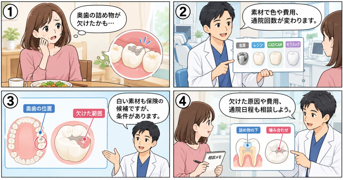 欠けた奥歯の詰め物、目立つ？保険と自費の違い・白い素材の条件