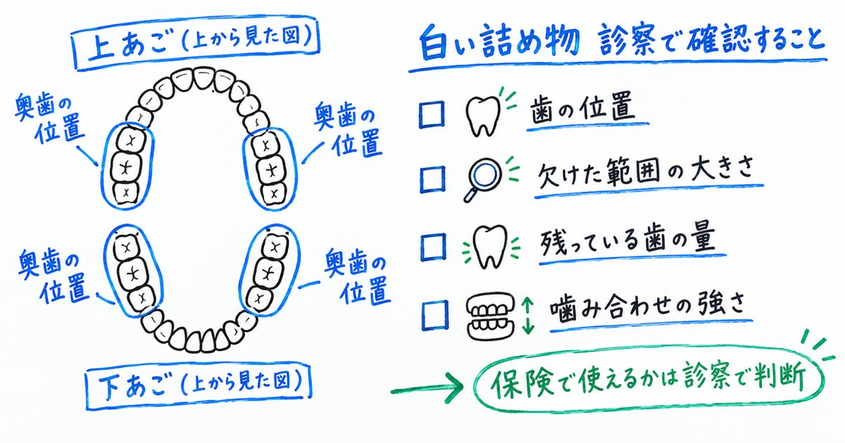 白い詰め物に保険は使える?歯の位置と費用の確認事項