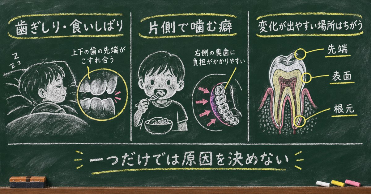 歯ぎしりや片側で噛む癖は、歯のすり減りとどう関係する？