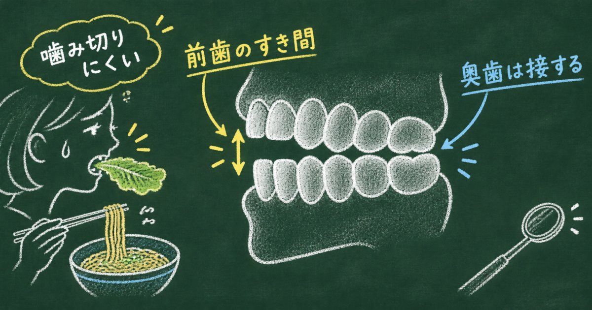 前歯が噛み合わず食べにくい？開咬の特徴・影響と相談の目安