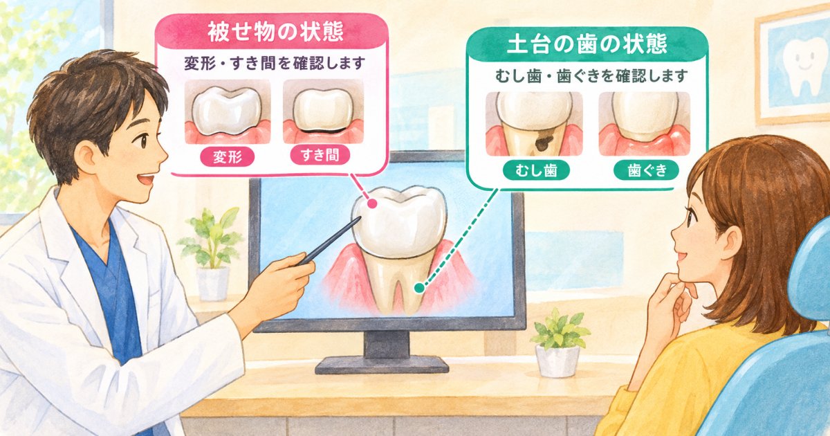 再装着できるか、作り替えが必要かは何を診て決まる？